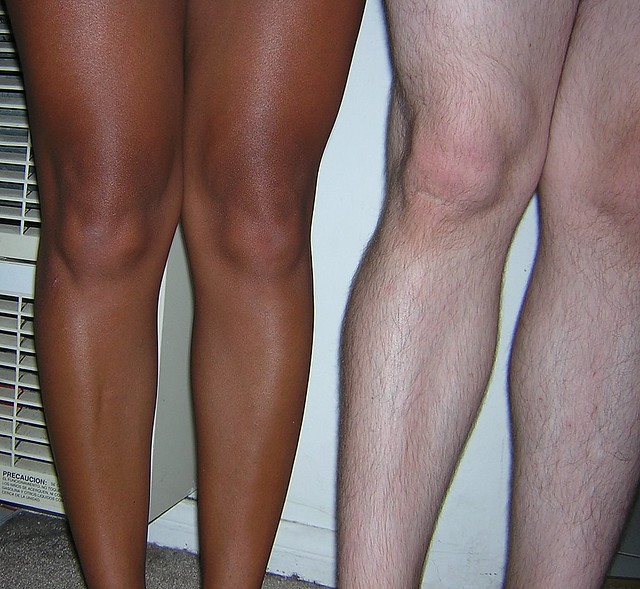 DIFERENTES TIPOS DE RODILLAS